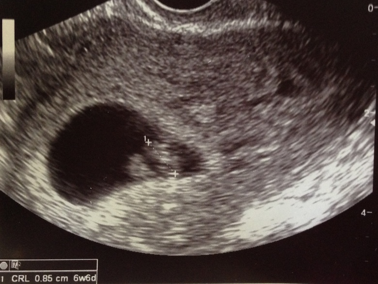 환타스틱 베이비